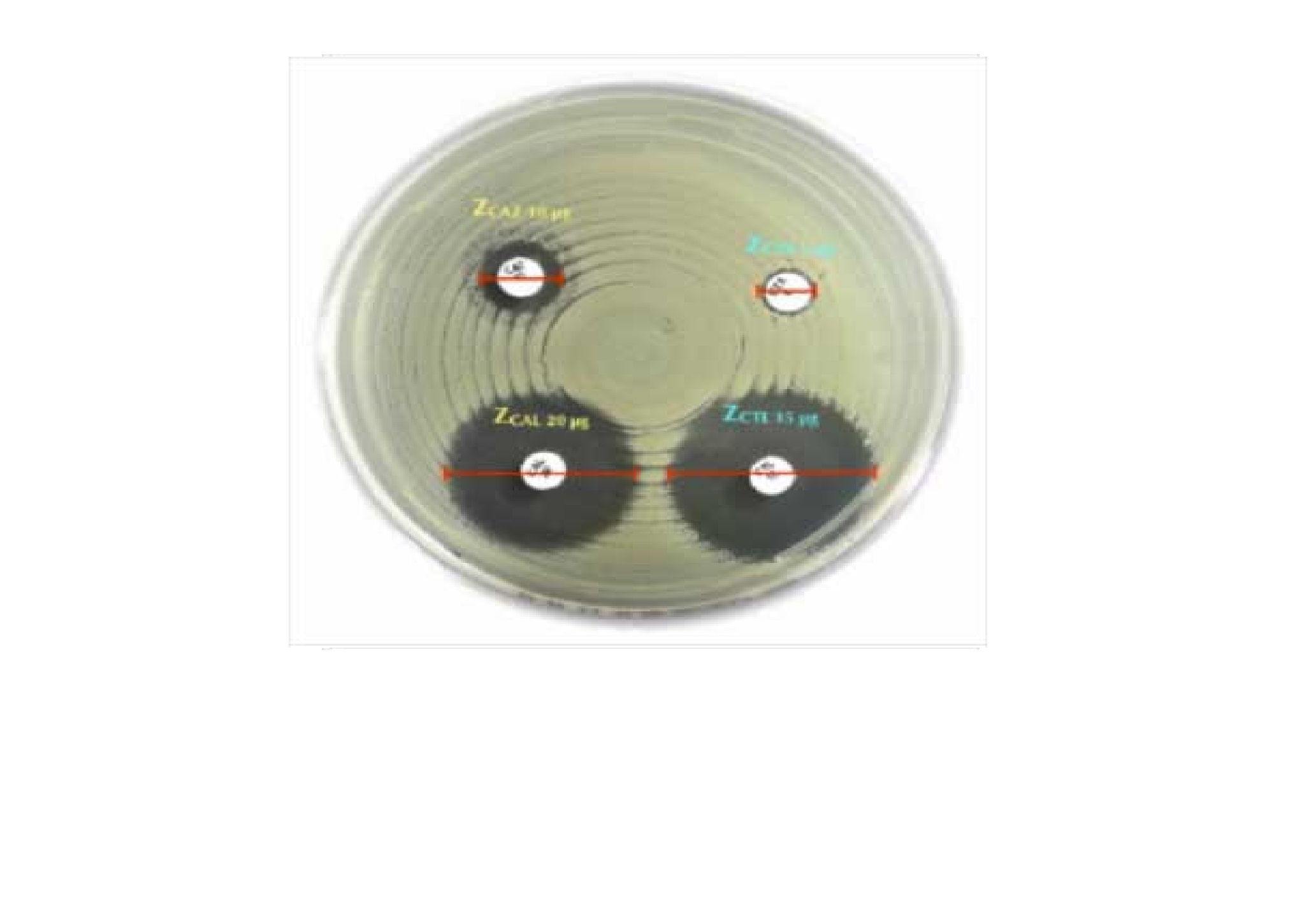 Antimicrobial Susceptibility Testing